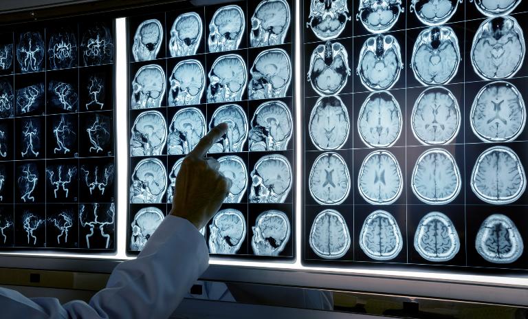 Nach einer leichten Erholung in 2016 hat sich die wirtschaftliche und finanzielle Lage der Kliniken in Baden-Württemberg wieder verschlechtert.