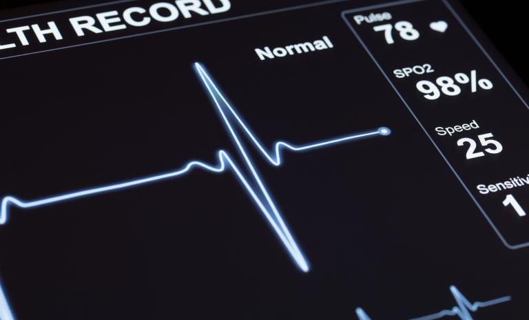 cardiogram